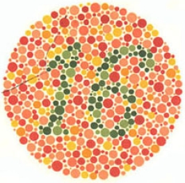 test item
