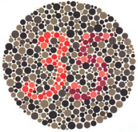 test item